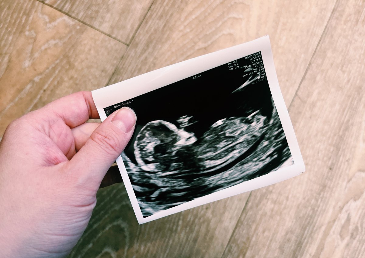 Gemma Milne tweet media