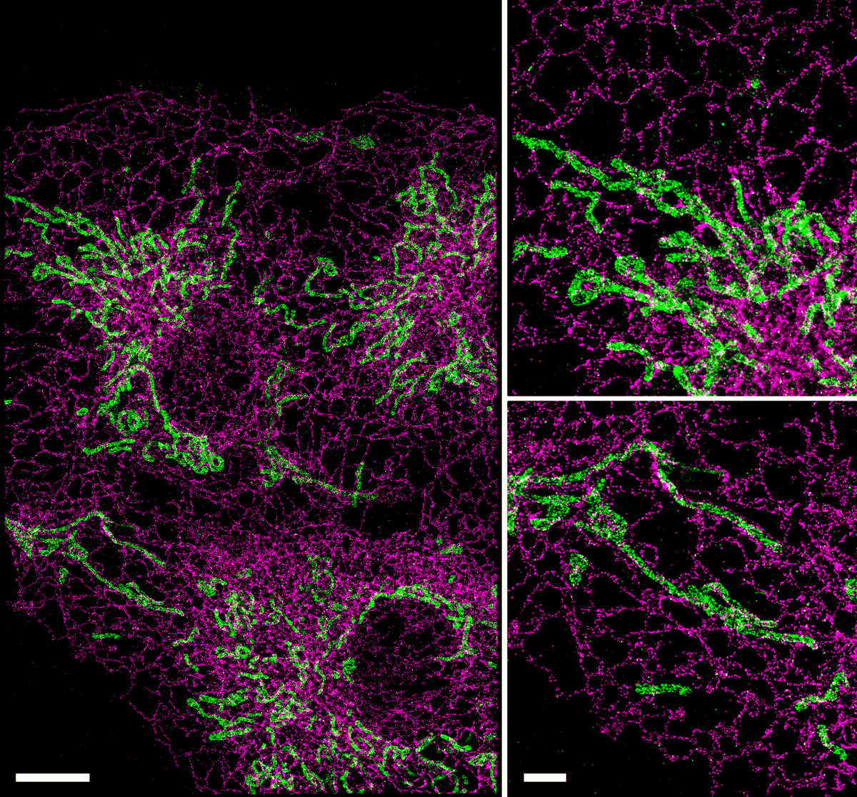 oniHQ's tweet photo. It's #FluorescenceFriday! Today we share dSTORM images of ER (CLIMP-63) - mitochondria (Tomm20) contact sites, taken using ONI's Discovery Kit: dSTORM in cells with a #Nanoimager.
Scale bars are 5 µm and 2 µm.

 #DiscoveryKit #superresolution #microscopy #dSTORM https://t.co/0YWp1wpVay