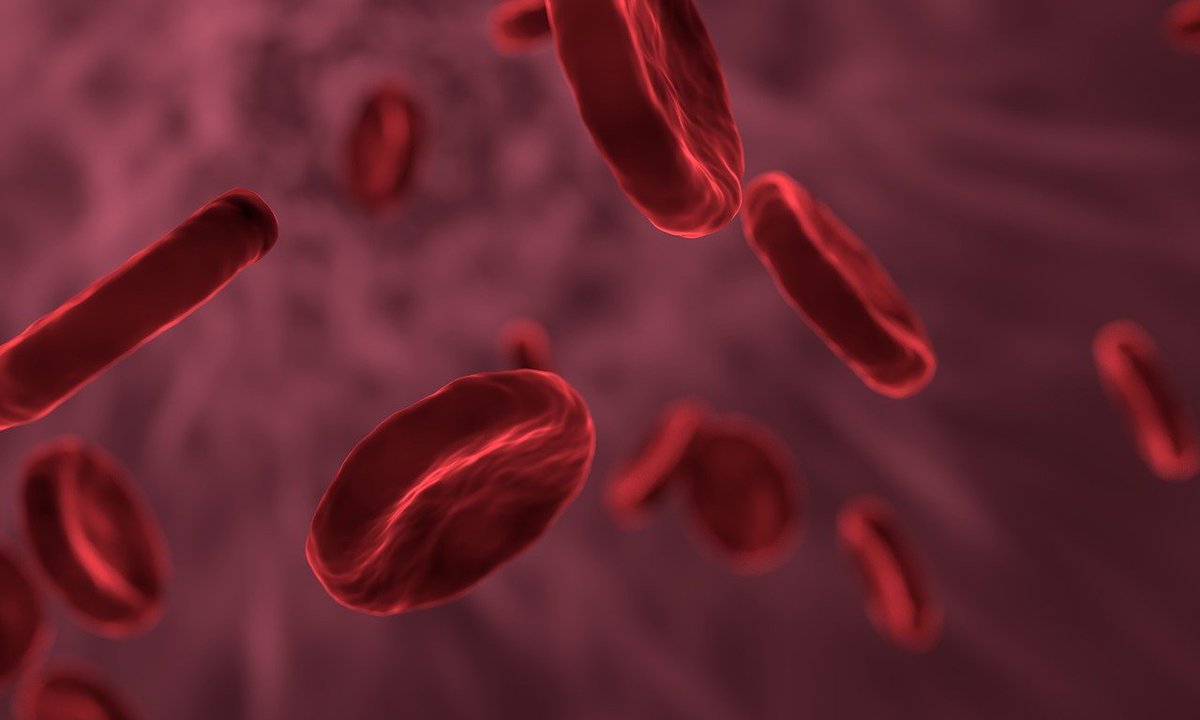 Research_ULH's tweet photo. Well done to our Pilgrim haem' team for the successful recruitment of our 1st patient to the ph2 IMG-7289-CTP-203 commercial study evaluating the safety and efficacy of bomedemstat in patients with PV.  With a target of 20 patients for the whole study it is an amazing achievement https://t.co/3HkUpmDUsz