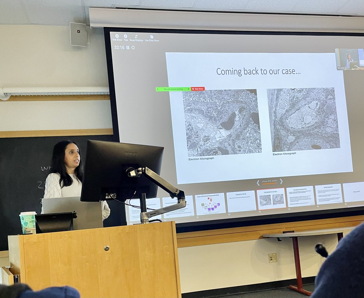 2nd year @UChicagoPCCM Crit Care-bound fellow @mehtakp73 presenting a stellar Renal Rounds this morning on “Renal Manifestations of Hematopoietic Cell Transplant” with guidance from @anushreeshirali! Great kick off to Yale Neph educational conferences in 2024 🎊