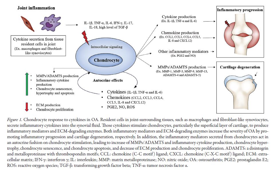 jrheum's tweet photo. Review Article
The Immunological Facets of Chondrocytes in Osteoarthritis: A Narrative Review
📰 https://t.co/c74HvgbRrH
#antigenpresentation #chondrocytes #cytokine #innateimmunereceptor #microbiota #osteoarthritis https://t.co/BCwhydZ2WE