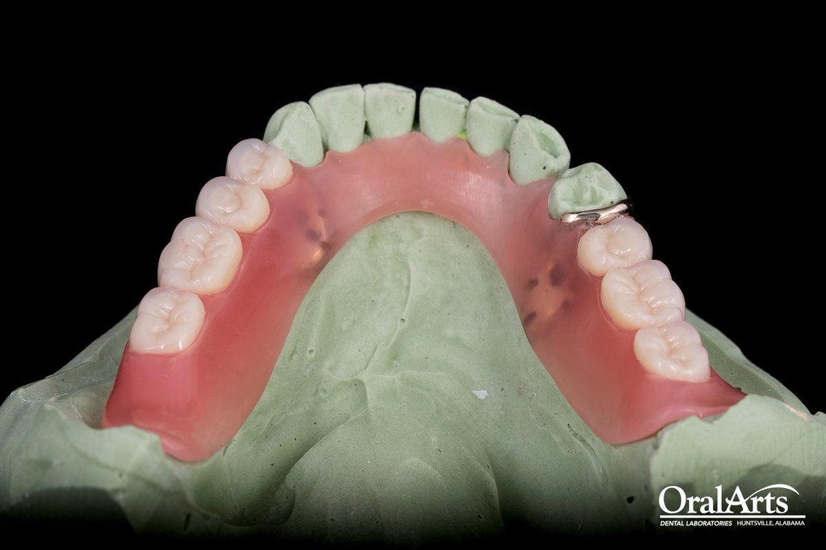 OralArtsDental's tweet photo. 🚀 Elevating smiles one flexi-denture at a time with #TCSUnbreakable! 🌟 Innovative, perfect blend, and insanely comfortable - they're a lifestyle upgrade! 🦷✨ #SmileRevolution #DentalChic 🚀 https://t.co/bpyIUtNioz