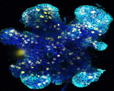 LabRawlins's tweet photo. Come and join us! We are recruiting a Research Assistant to work on a highly collaborative lung disease project using human organoids and CRISPR. Closing date 5th Feb. @GurdonInstitute with friendly colleagues in Leicester/Nottingham.
https://t.co/simKVj2s5X https://t.co/XUQvvJnegp