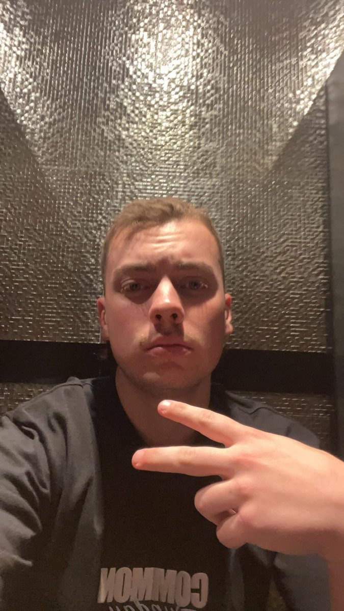 Imagine looking like this. Receding at 20 years of age is lowkey crazy