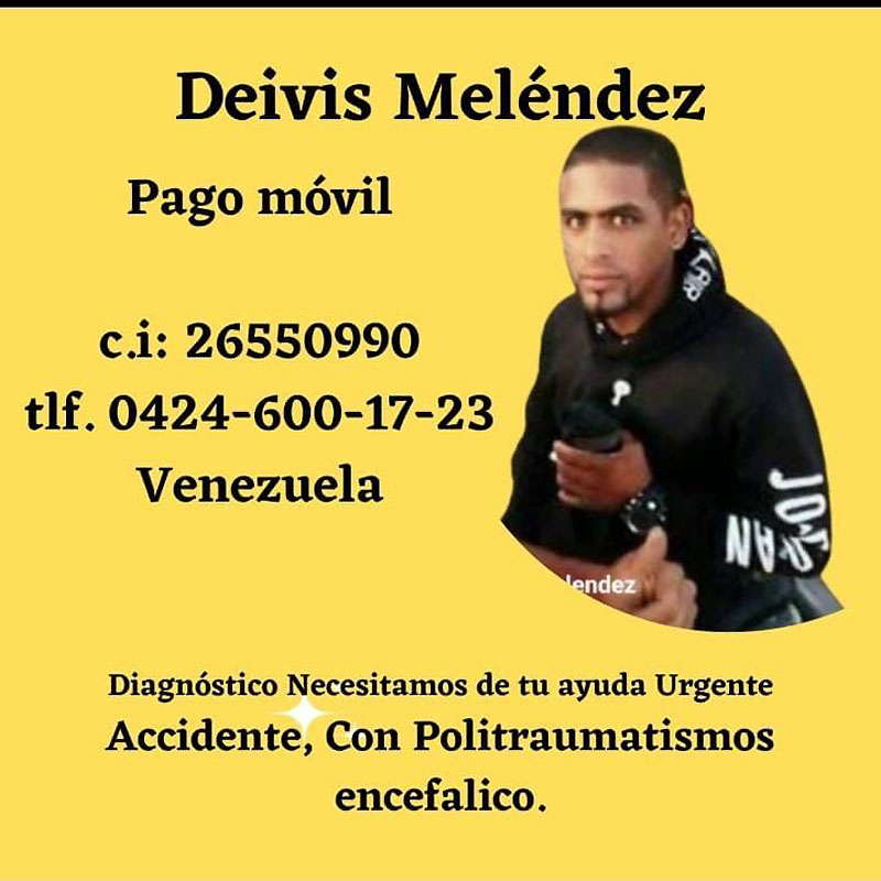 InfoElRegional's tweet photo. Familiares de los heridos en el accidente de moto y bus en Cabimas piden ayuda para gastos médicos https://t.co/zJC4iAsmiA