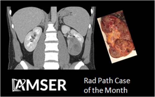 👀🧠Want to check out some interesting Rad Path Cases of the Month? Look no further than...

aur.org/radpath-case-o…

So many interesting cases in one location!

#MedEd #radiology #medstudent #RadEd #COTM
