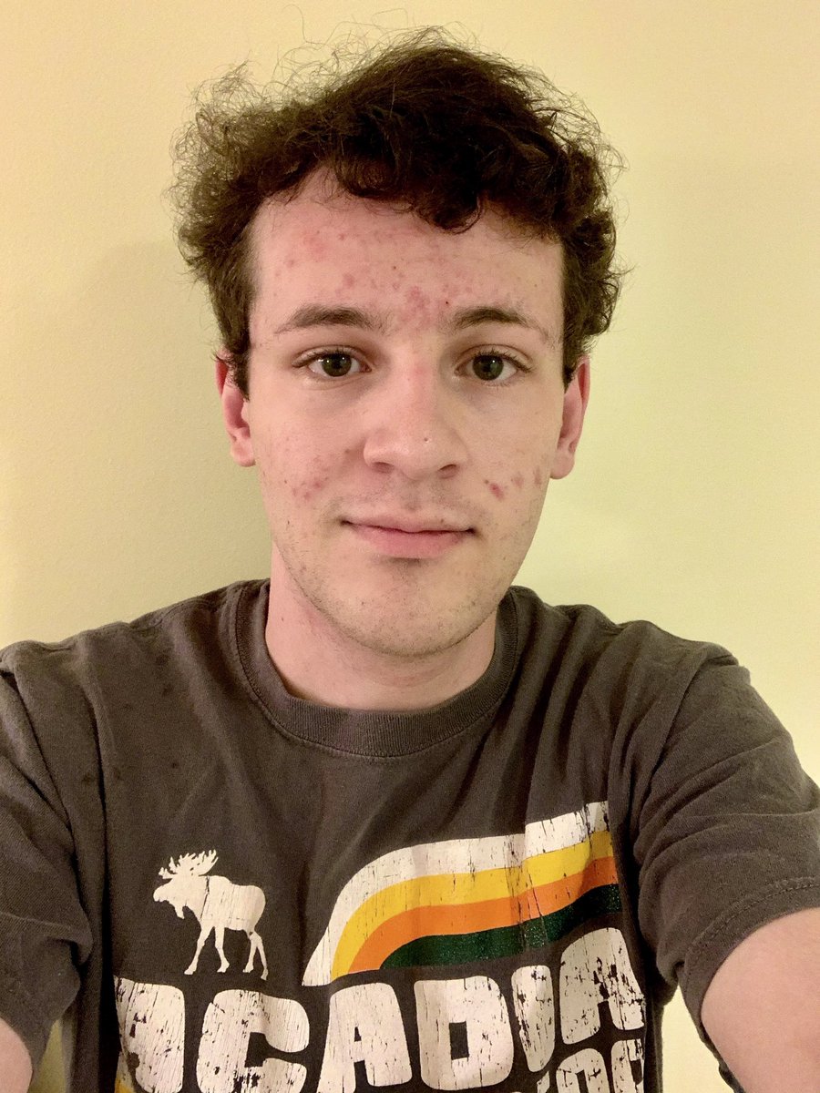 photo of me pre-estrogen in 2020 with very short hair, bad acne, stubble, and a very masculine face