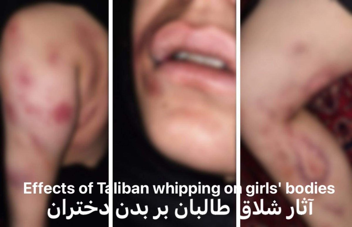 HomaHazara1000's tweet photo. The Situation of Girls who were arrested by the Taliban for wearing bad Hijab،
Hijab is an excuse.
I am so boring from this situation.!
#StopHazaraGenocide https://t.co/go9KKFFBNi