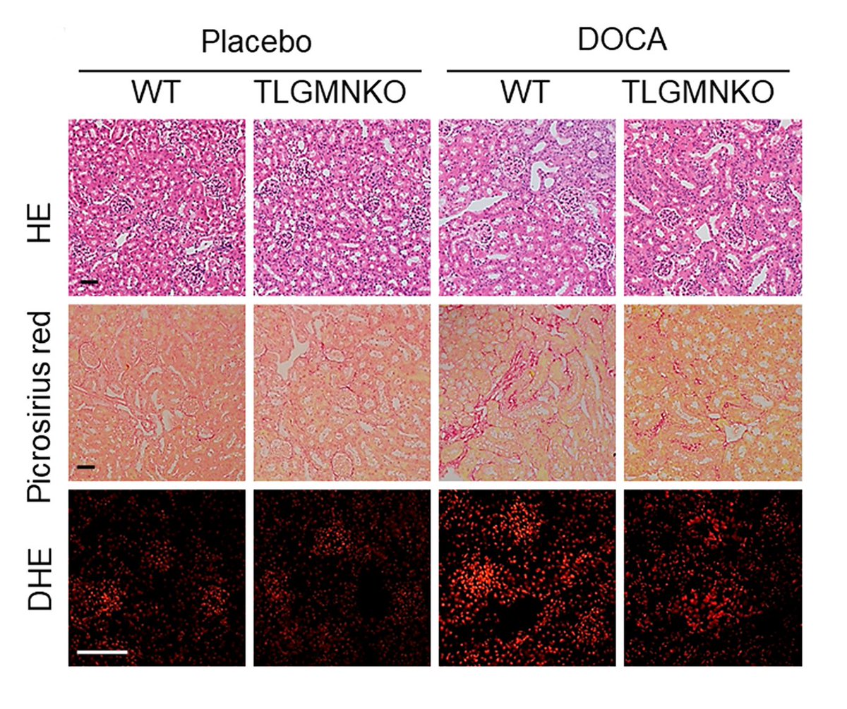 CircRes's tweet photo. He &amp; colleagues found that #LGMN degrades #TRAF6, a protein crucial for T reg development and function.  Learn how inhibiting LGMN or boosting TRAF6 in #Tegs could be a novel avenue for treating #hypertension at https://t.co/T5Nf8ool5r    

@CentralSouth_U https://t.co/SRb9IAvOC7