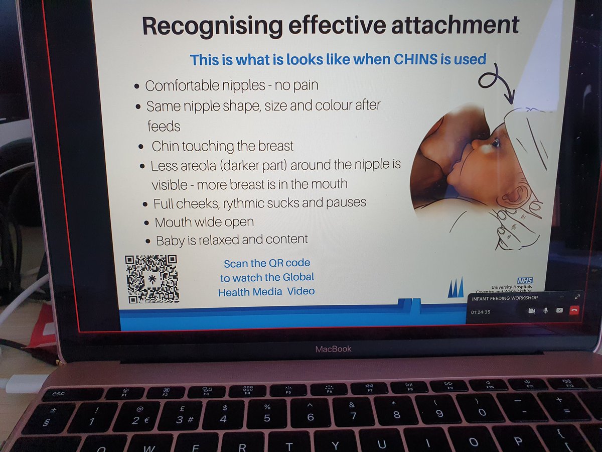 Jaspreet Garcha RM (@jasgarcharm) on Twitter photo Join our next infant feeding workshop on the 18th January via our Linktree linktr.ee/uhcwinfantfeed… & eventbrite.co.uk/o/uhcw-antenat…
Brain development and relationship building happens during pregnancy 🧠 #infantfeeding #responsive #breastfeeding <a href="/nhsuhcw/">UHCW NHS Trust</a> #maternity Join our next infant feeding workshop on the 18th January via our Linktree linktr.ee/uhcwinfantfeed… & eventbrite.co.uk/o/uhcw-antenat…
Brain development and relationship building happens during pregnancy 🧠 #infantfeeding #responsive #breastfeeding <a href="/nhsuhcw/">UHCW NHS Trust</a> #maternity