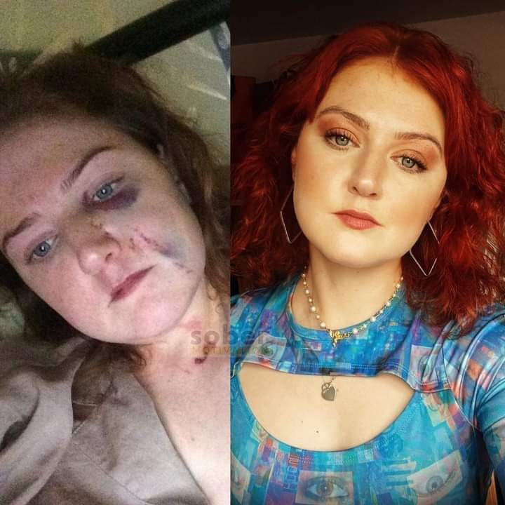 Sober_lifestyl's tweet photo. 15 months sober today🙌 https://t.co/erJVfwyXSg