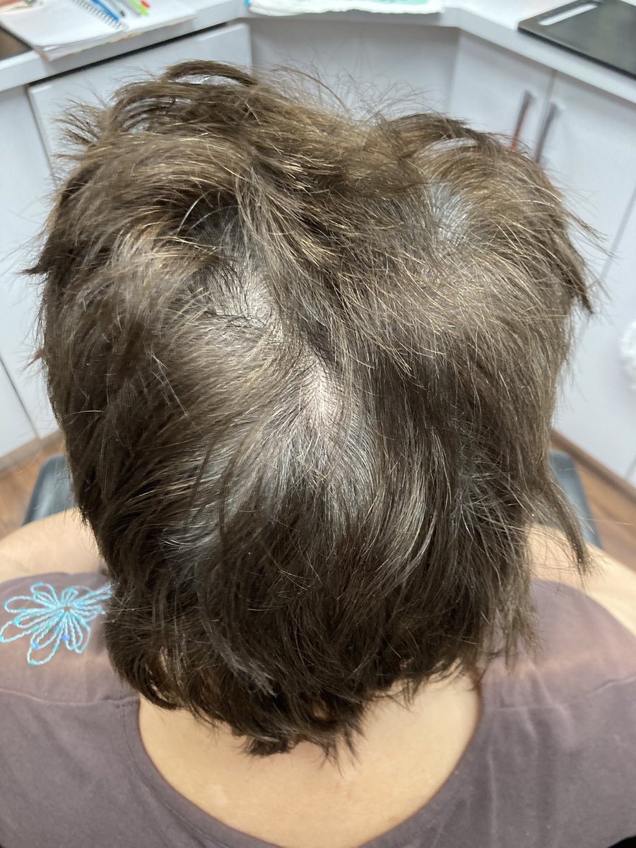 Hairstudio1mn's tweet image. #BaseColor 
#FewFoils 
#CaramelToner 
#Haircut 
#blowdryStyle 
#Hairstudio1Oakville ✂️
#FreshLook2024