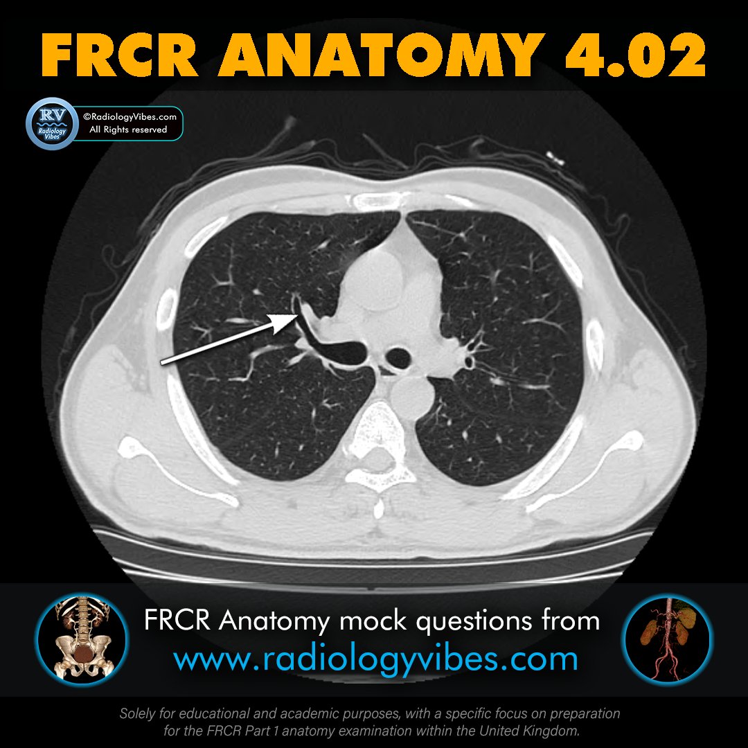 FRCR Anatomy 4.02: Name the arrowed structure. #radres #FOAMrad #FRCR #radiology #anatomy #MedTwitter #radtwitter #FRCRanatomy @Radiology_Vibes @anatomy4frcr @_the_SRT