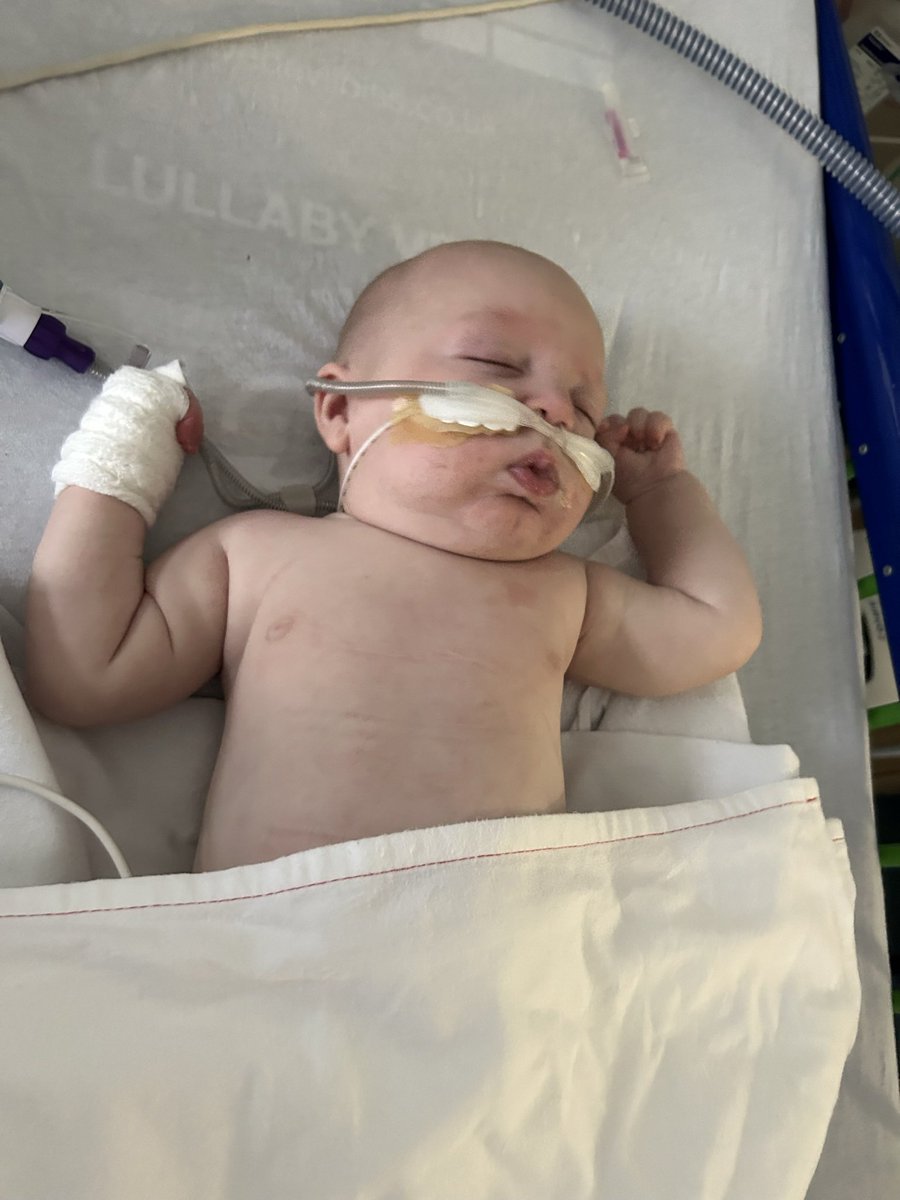 clare_xox's tweet photo. RSV Awareness - do not kiss, hold, touch a baby that isn’t yours without permission.
These pics are pre ventilation in PICU. RSV with bronch kills babies and their health is so much more important than you wanting to ‘love’ them :( https://t.co/Y6bcxT7WRA