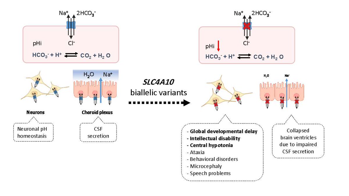GIMJournal's tweet photo. New gene-disease association! Biallelic variants in SLC4A10 cause a variable neurodevelopmental disorder https://t.co/GAKEPpn6k3 #Neurogenetics #GenotypePhenotype https://t.co/10oQPxl3jM