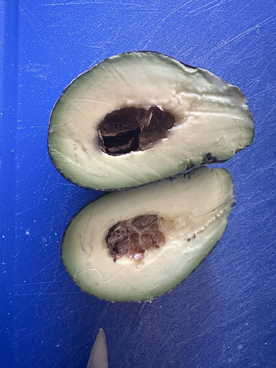 Reminded today, why I never NEVER cut an avocado 🥑 into my hand. 
🔪Always cut down away from hand and onto cutting board.
Because sometimes the seed is very thin or nonexistent. #SurgeryTwitter #HandSurgery #AvocadoSafety