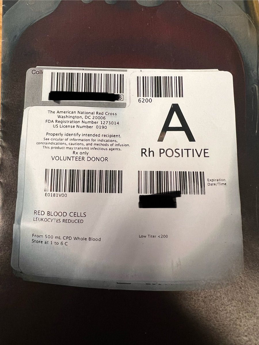 TeamCaptainJohn's tweet photo. Look at this crazy pRBC unit!
What is with this unit? Why am I intrigued by it?
How long is it good for?
Can you make up a story for why it exists?
#Blooducation #BloodBank #ClinLab #MedLabLife https://t.co/JgAD0ThSZO