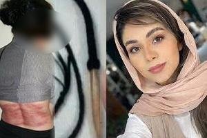 KarmelMelamed's tweet photo. DON'T LOOK AWAY!

This is Roya Heshmati, a woman in Iran who just received 74 lashes from mullah regime thugs for not wearing an Islamic veil to cover her head.

Where the hell is the outrage from #MeToo crowd, U.S. feminists &amp; Hollywood celebrities who cry about Gaza 24/7?! https://t.co/E5cY48ZwZ9