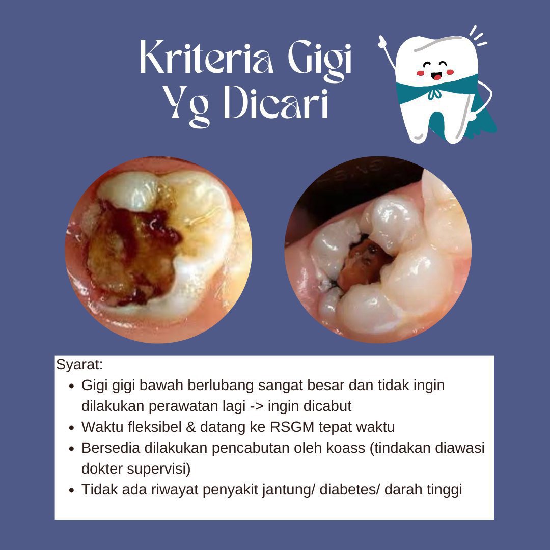 another_dryp's tweet photo. @BaseBDG Halo kaka2 saya mahasiswi koas fkg yg sdg mencari pasien, bagi yg berdomisili bandung & memiliki gigi berlubang sangat besar, tdk memiliki penyakit jantung/diabtes/drah tinggi & ingin dicabut dpt menghubungi saya melalui DM twitter/ line (vnssadryp). Trimakasih🙏🏻 #koass #Bandung https://t.co/G4XFpdwfhk