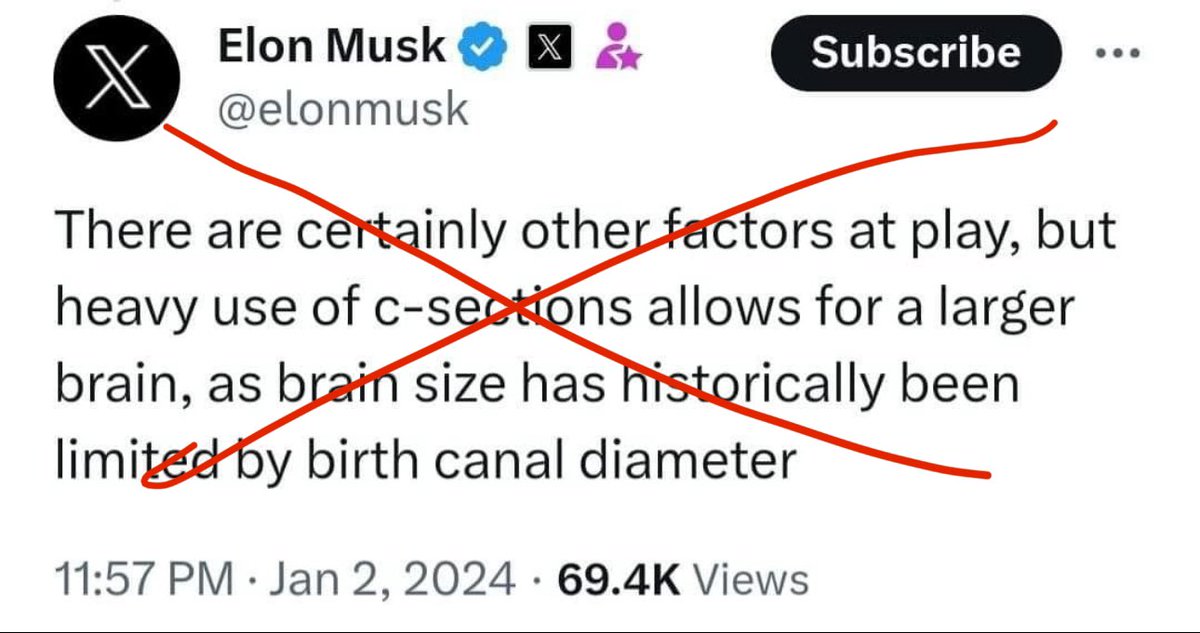 A) Mode of delivery has no influence on final head/brain size

B) Head/brain size has no correlation with intelligence 

C) Elon Musk is a fool, especially when it comes to medical stuff