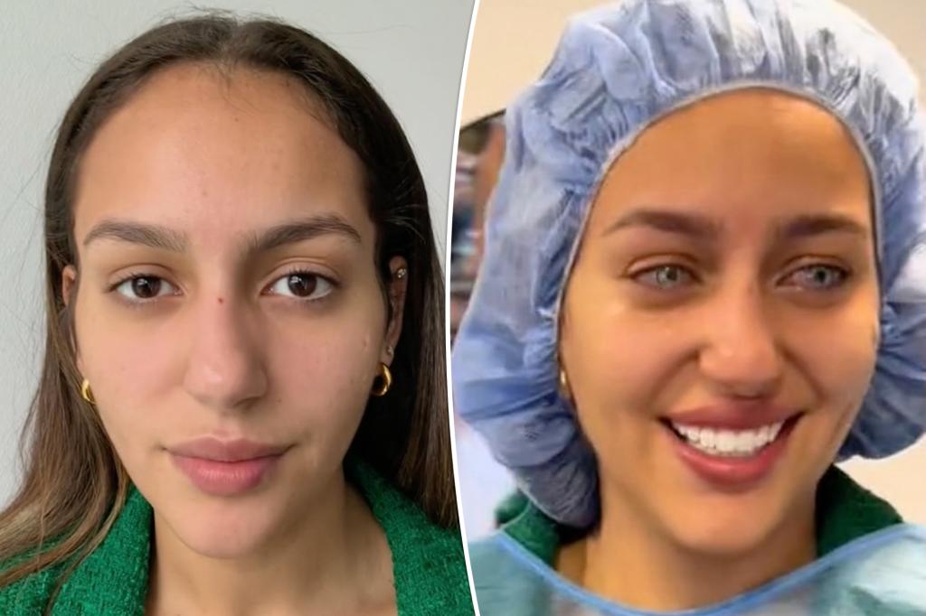 nypost's tweet image. This cosmetic procedure to change eye color is going viral — but so are the horror stories trib.al/UJ7wbYQ