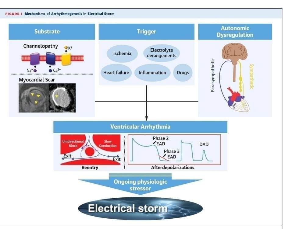 ZHeart11768530's tweet photo. Management of Electrical Storm: JACC State-of-the-Art Review #2023review 

https://t.co/BxYQzfNFUV
 #CardioTwitter #CardioEd #cardiology #OpenAccess #2023review #VT https://t.co/8xCjiJFExi