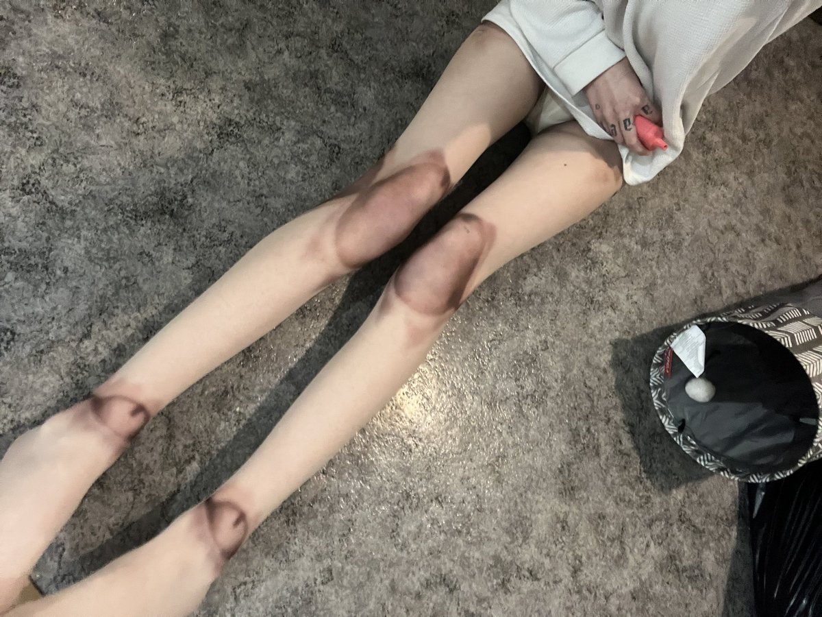 𝒞𝒽𝑒𝓇𝓇𝓎✧𝓅𝒾𝒸𝓀𝒾𝓃𝑔 tweet media