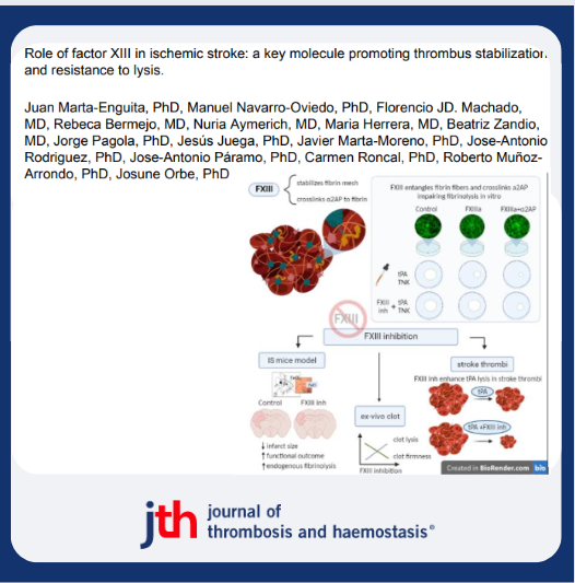JTHjournal's tweet photo. Coagulation FXIII catalyzes fibrin crosslinking modulating clot stiffness and lysis resistance in #stroke thrombi, 

&amp; its inhibition reduces infarct size and neurological deficits in a stroke mice 🐁model.
@jmartaen @Cima_unav @neuro_servet @idisnanavarra
https://t.co/1TeSSvbkUt https://t.co/2xr5XefA7p