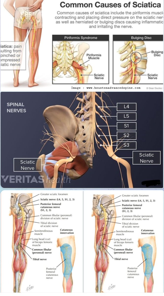 SCIATIC NERVE:

Branches:
-Muscular branches 
-Tibial n
-Common fibular n

Motor:
Muscles of posterior thigh,ischial portion of adductor magnus, muscles of posterior, anterior,lateral compartments of  leg, foot muscles.

Sensory:
Lateral &amp; posterior leg, Dorsum &amp; sole of the foot