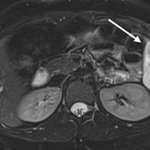 Photo by RadiologyCaseReports (@RadCaseReports)