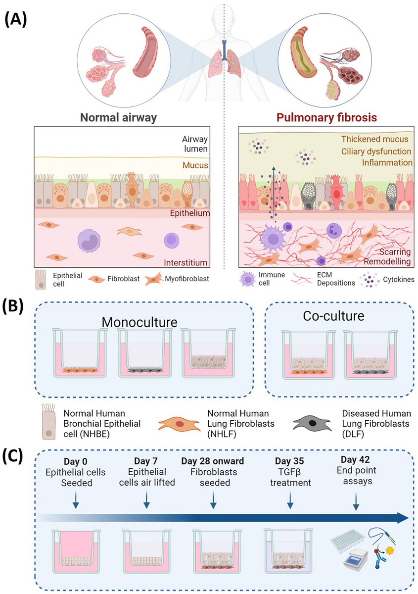 Pulmonary Cell News (@pulmonary_news) on Twitter photo 🥼 <a href="/BiotechBarron/">Dr Sarah Louise Barron</a>, <a href="/biochemist_hero/">Dr Roisin Owens</a> & colleagues used a human-derived in vitro air liquid interface culture to model bronchial epithelial-fibroblast cross-talk in idiopathic #PulmonaryFibrosis. 🧫
Learn more about their system's utility:
➡️ go.nature.com/48qh2yu 🥼 <a href="/BiotechBarron/">Dr Sarah Louise Barron</a>, <a href="/biochemist_hero/">Dr Roisin Owens</a> & colleagues used a human-derived in vitro air liquid interface culture to model bronchial epithelial-fibroblast cross-talk in idiopathic #PulmonaryFibrosis. 🧫
Learn more about their system's utility:
➡️ go.nature.com/48qh2yu