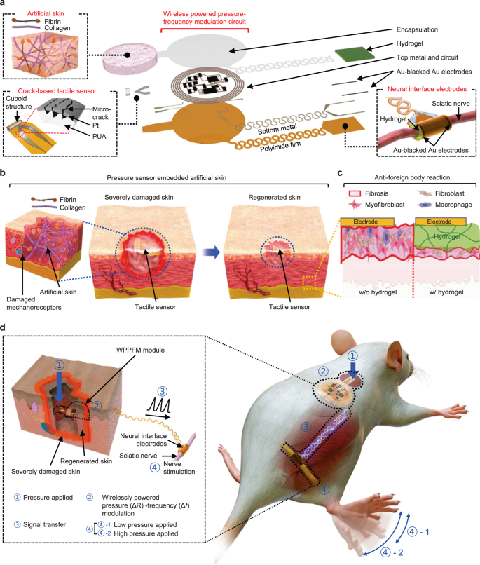 DermalCell's tweet photo. 📢 New in @NatureComms!

Scientists describe bionic #ArtificialSkin with a fully implantable wireless tactile sensory system for #WoundHealing and restoring skin tactile function — sounds pretty cool! 🤖 

📎 https://t.co/NJQ8Poi2Am https://t.co/Cm7xiu3h4o