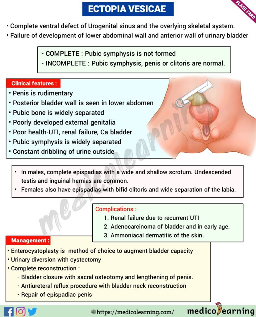 1-Dx:Bladder exstrophy(Ectopia vesicae),
DDx: omphalocele, gastroschisis, and cloacal exstrophy.
2-trt: Enterocystoplasty 
• Urinary diversion with cystectomy
• Complete reconstruction 
3- (EEC) comprises 
epispadias, classic bladder exstrophy, and cloacal exstrophy