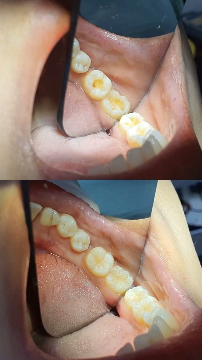 dailydoseofmood's tweet image. I really love my job because it’s ✨art✨
#directcomposite #directposterior