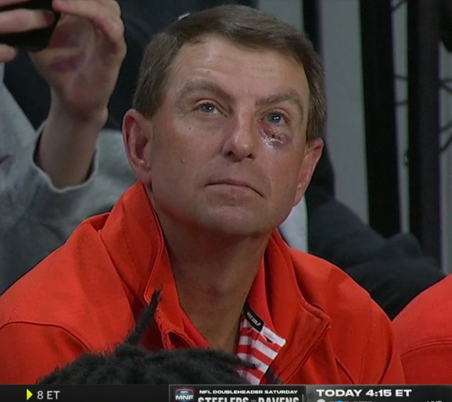 TheFieldOf68's tweet photo. Who gave Dabo Swinney a black eye?

Wrong answers only. https://t.co/1TOM53QTR3