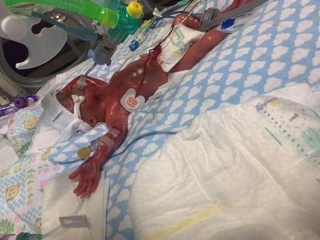 Baby Born at 23 Weeks and Given 5% Chance of Surviving Just Celebrated His 3rd Birthday buff.ly/3GL8EhG