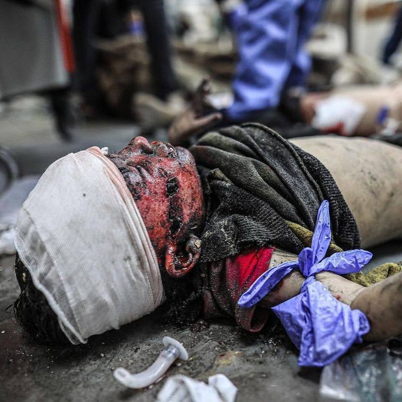 Gaza | Night falls and the massacres by the Israeli occupation begin