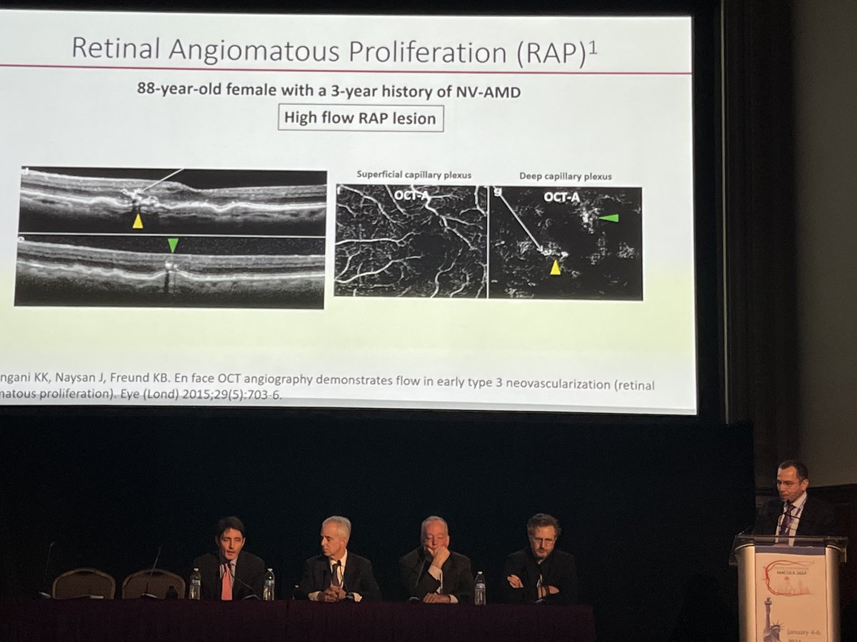 Experts discussed how they choose the right drug for patients with wet AMD. Pictured here: Nicolas A. Yannuzzi, MD; Carl D. Regillo, MD; David M. Brown, MD, FACS; Michael J. Cooney, MD, MBA; and Marco A. Zarbin, MD, PhD (moderator). #ACRC2024 #Retina #Macula2024