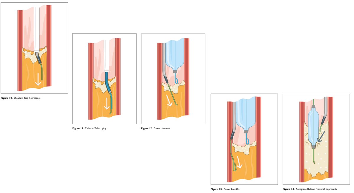 Hady Lichaa, MD, FACC, FSCAI, FSVM, RPVI tweet media