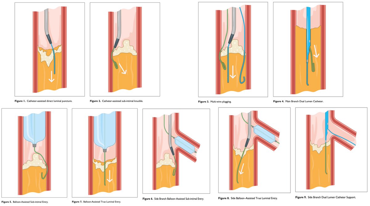 Hady Lichaa, MD, FACC, FSCAI, FSVM, RPVI tweet media