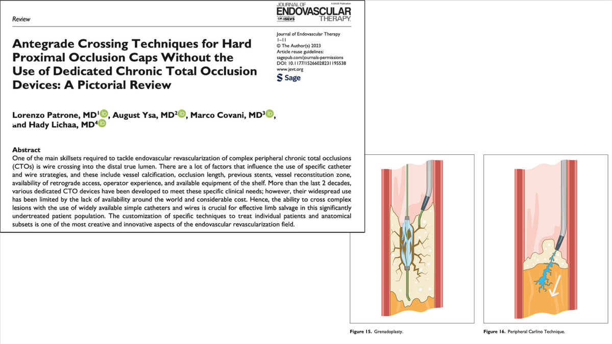 Hady Lichaa, MD, FACC, FSCAI, FSVM, RPVI tweet media