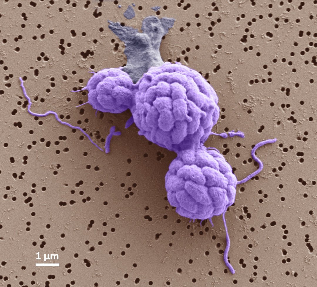 George Schaible (@schaiblegeorge) on Twitter photo I will be giving my PhD defense on Wednesday January 10th at 11am MST for anyone that is interested in multicellular bacteria, cultivation independent techniques, and magnetotactic bacteria. DM me for the Zoom link! <a href="/LIFE_RCN/">LIFE: From Early Cells to Multicellularity</a> #multicellularbacteria #magnetotactic I will be giving my PhD defense on Wednesday January 10th at 11am MST for anyone that is interested in multicellular bacteria, cultivation independent techniques, and magnetotactic bacteria. DM me for the Zoom link! <a href="/LIFE_RCN/">LIFE: From Early Cells to Multicellularity</a> #multicellularbacteria #magnetotactic