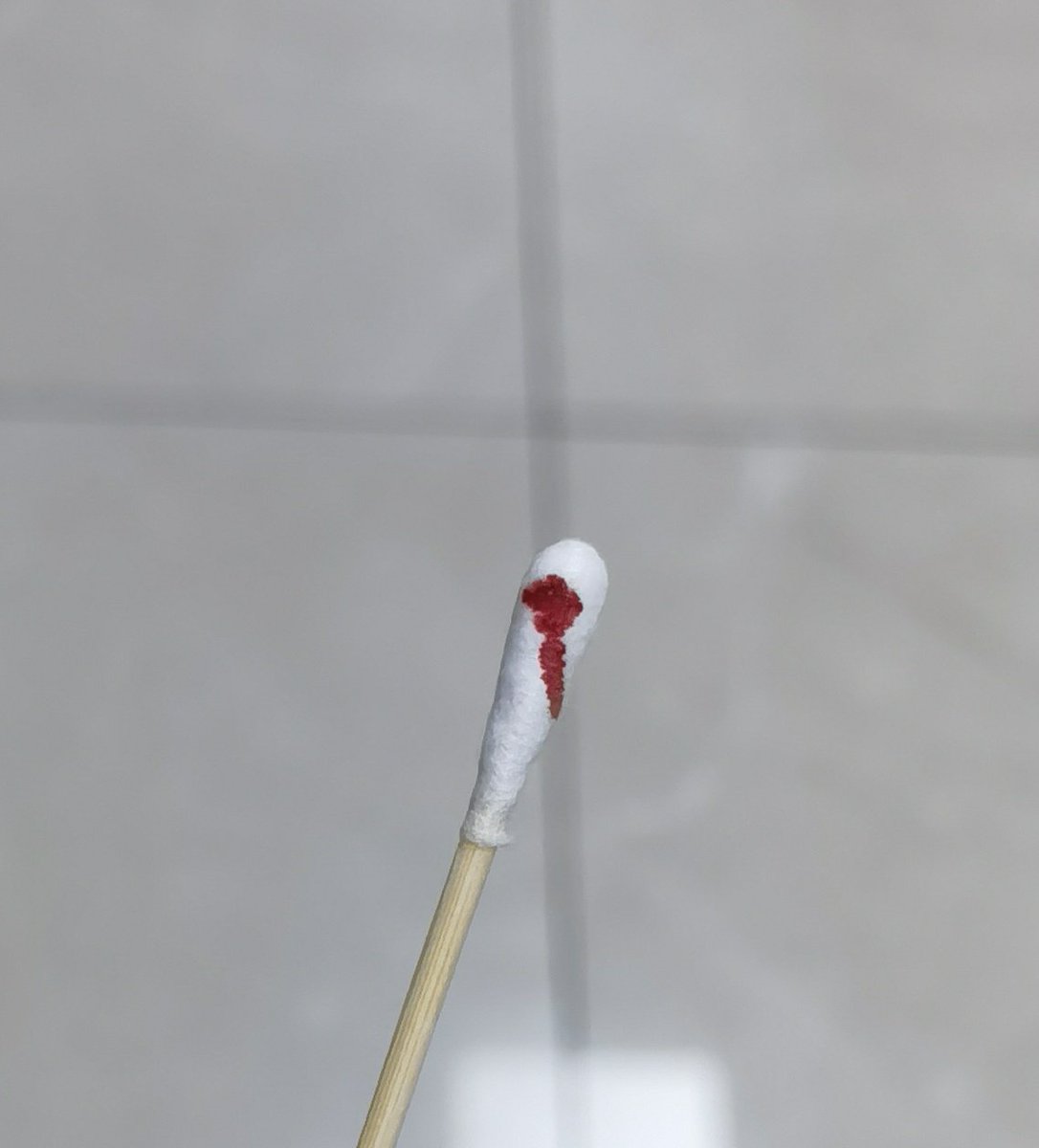 唉。小花