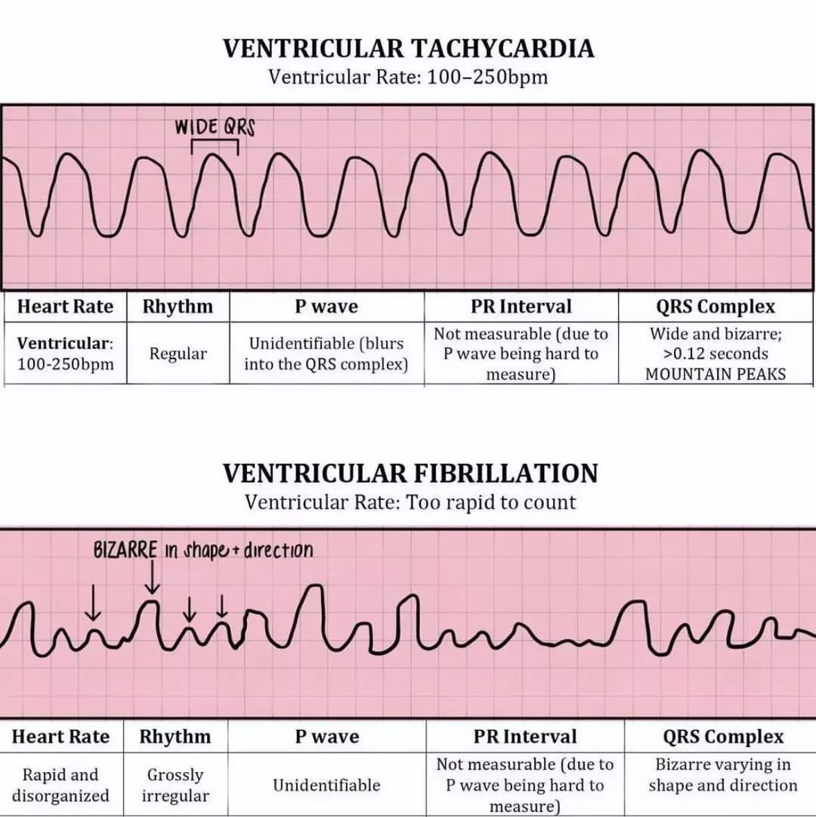 asmar097's tweet photo. Difference between VF and VT https://t.co/2ZUTg7BX15