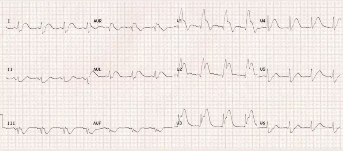 asmar097's tweet photo. Middle-aged patient presenting with chest pain https://t.co/0QQLAZjYav