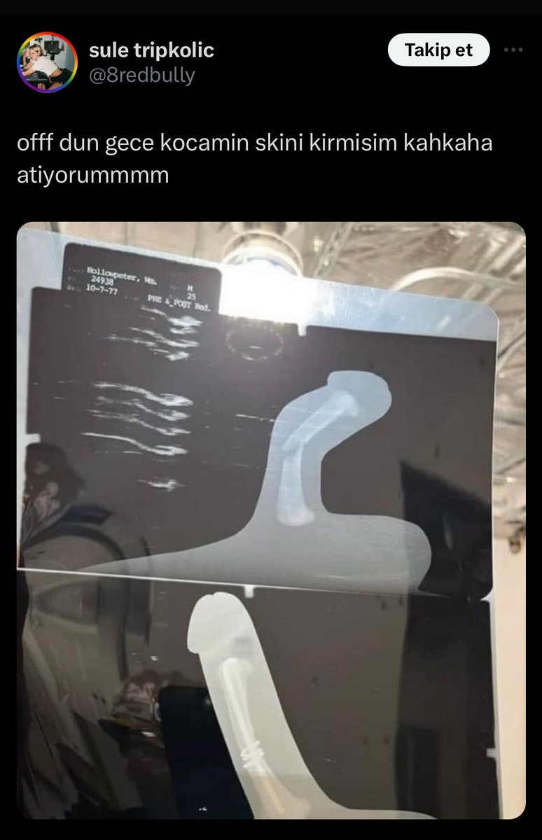 absürt olaylar (@absurtolaylar) on Twitter photo 