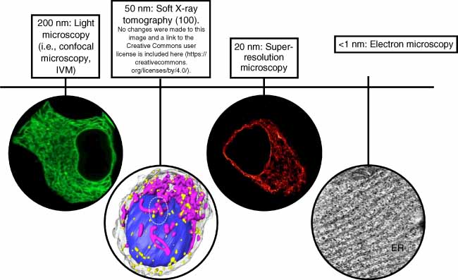 Dr. Carmella EvansMolina (@cevansmo) on Twitter photo Interested in a primer on imaging techniques to characterize subcellular organelle structure in β cells? Check out our new review authored by the brilliant <a href="/IUMedSchool/">IU School of Medicine</a> <a href="/IUSweetTweets/">Center for Diabetes and Metabolic Diseases</a> <a href="/LifeAtPurdue/">Purdue University</a> MSTP student <a href="/MRMcLaughlin_13/">Madeline McLaughlin</a> tinyurl.com/3pmnfuev Interested in a primer on imaging techniques to characterize subcellular organelle structure in β cells? Check out our new review authored by the brilliant <a href="/IUMedSchool/">IU School of Medicine</a> <a href="/IUSweetTweets/">Center for Diabetes and Metabolic Diseases</a> <a href="/LifeAtPurdue/">Purdue University</a> MSTP student <a href="/MRMcLaughlin_13/">Madeline McLaughlin</a> tinyurl.com/3pmnfuev