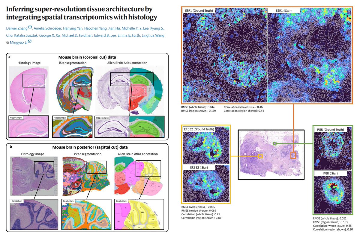 HaoYin20's tweet image. iSTAR (Inferring Super-resolution Tissue ARchitecture)
Predict spatial gene expression at single-cell &amp; whole-transcriptome level
based on #Xenium (&lt;1000 genes) #Visium (Not single-cell) #SpatialTranscritomics + HE histology
#HierarchicalVisionTransformer for histology feature…