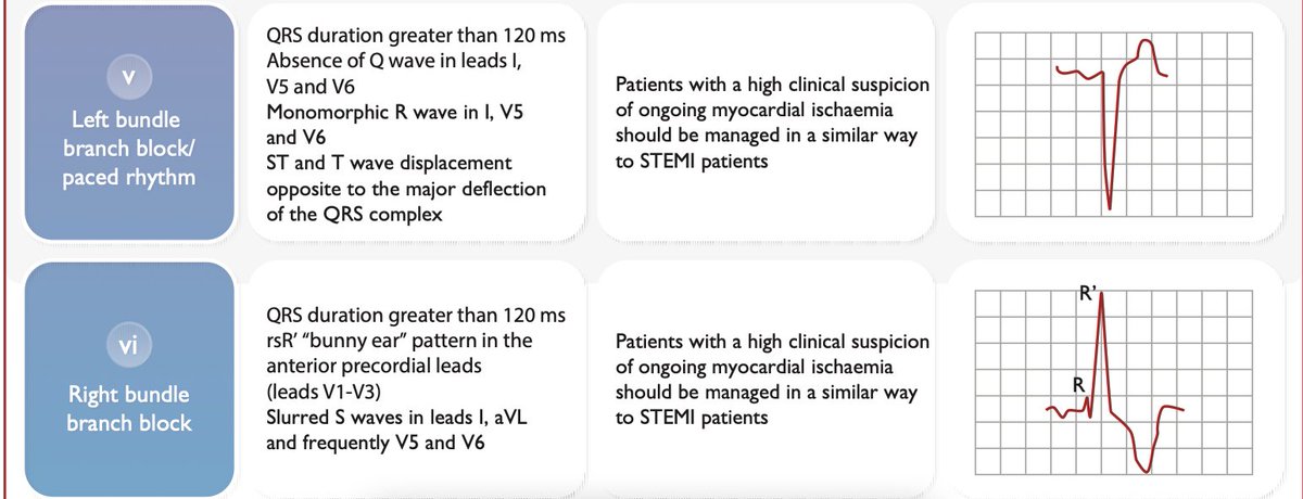 ECG patterns of Acute Coronary Syndromes: 1/2 ESC 2023 Guidelines #cardiology #CardioTwitter #MedEd #ECG #CardioEd #CVD