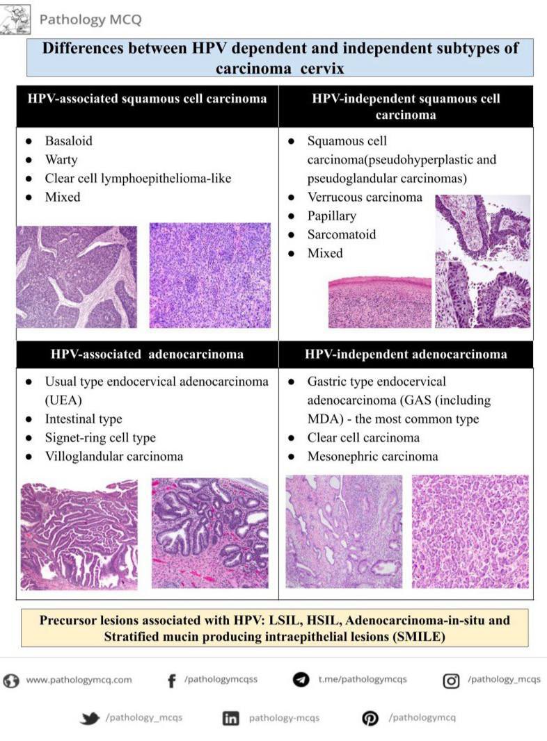 Differences between HPV dependent and independent carcinomas of cervix #pathologynotes #pathologysummaries #pathologymcq #pathologyflashcards #pathologists #pathology #neetss #frcpath #frcpath1